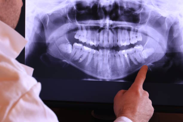 Best Emergency Dental Care for Broken or Chipped Teeth in White Sulphur Springs, MT